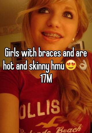 Hot Teen Girls With Braces